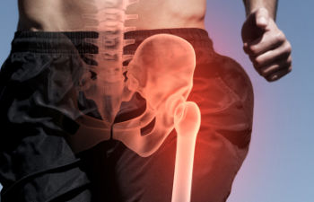 Hip Pain Relief & Surgical Treatment Options