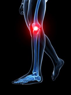 Calf Muscle Strain, Lower Extremity, Services & Treatments