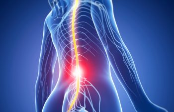 Low Back Strains and Sprains - Atlanta Brain and Spine Care