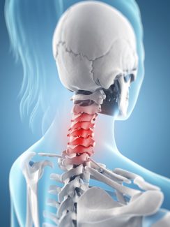 🥇 Neck Pain Treatment, Relief from Neck Pain