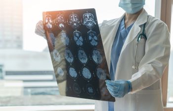 A doctor reviewing brain X-rays.