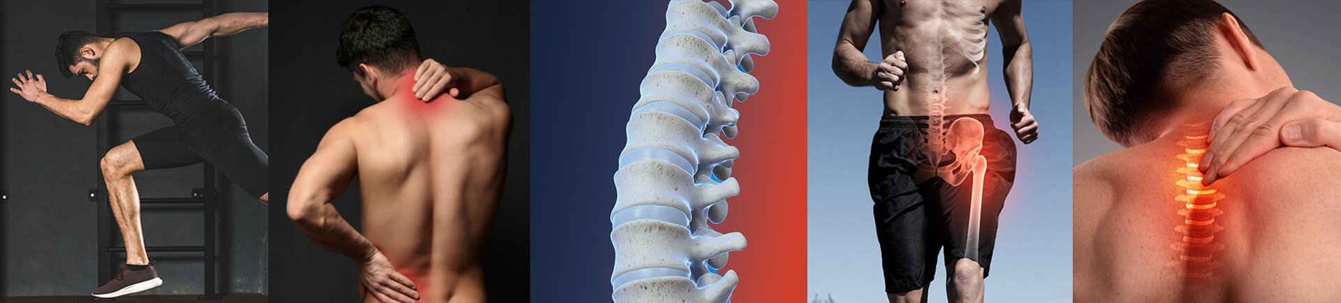 Does Severe Back Pain Mean the End of an Active Lifestyle? Atlanta, GA