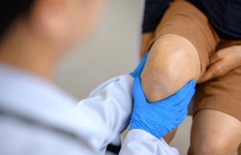 An orthopedic doctor wearing medical gloves An orthopedic doctor examines a patient's knee joint to analyze the cause of osteoarthritis in his office at the hospital.